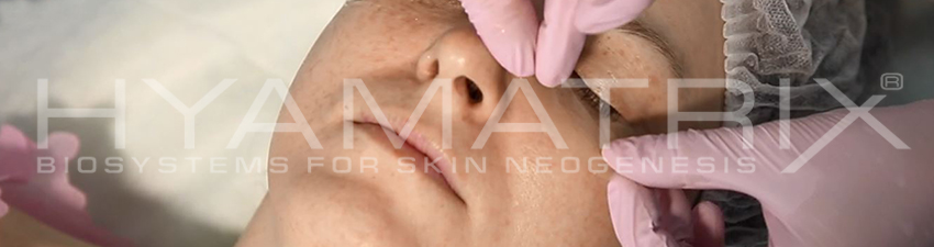 Hyamatrix гель для интенсивного ухода за кожей вокруг глаз